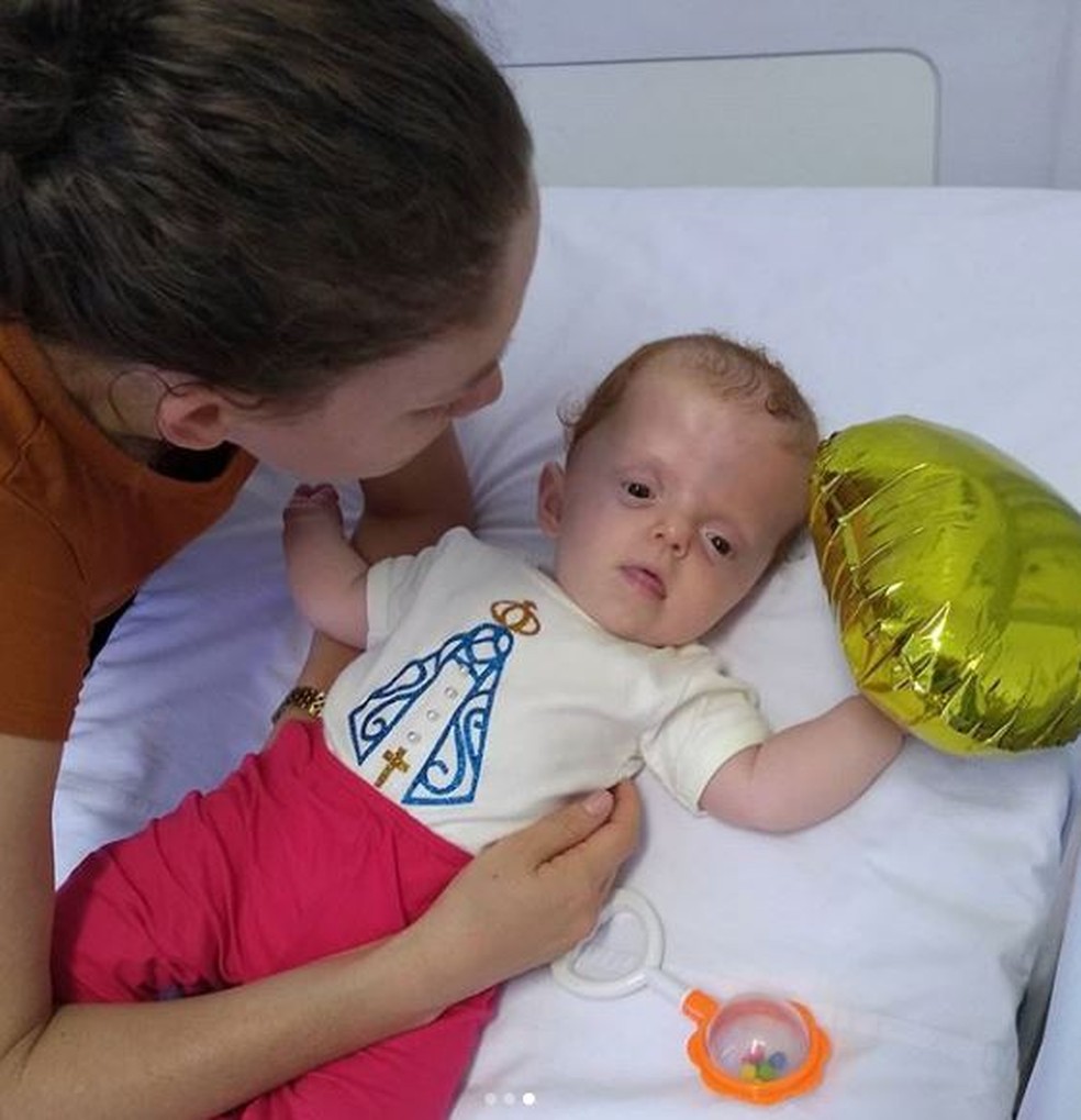 Luna, de Angatuba (SP), foi diagnosticada com Síndrome de Apert e passou por cirurgia — Foto: Cassiana Oliveira/Arquivo Pessoal