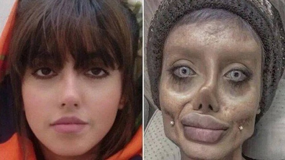 A maquiadora e influencer iraniana Sahar Tabar dizia ter feito mais de 50 cirurgias para ficar parecida com Angelina Jolie