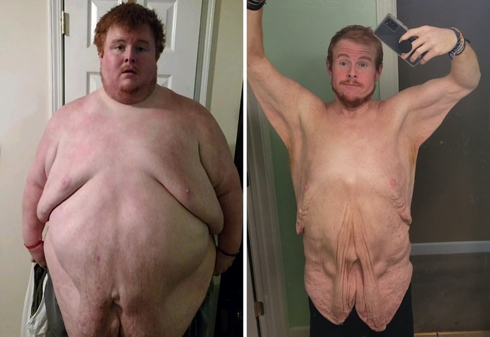 Casey King mostra sua perda de peso nas redes — Foto: Reprodução/Instagram