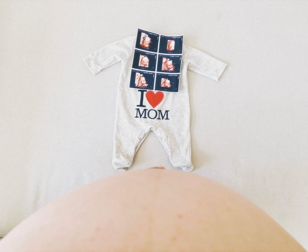 Marilia Mendonça mostra imagens do ultrassom do primeiro filho (Foto: Reprodução/Instagram)
