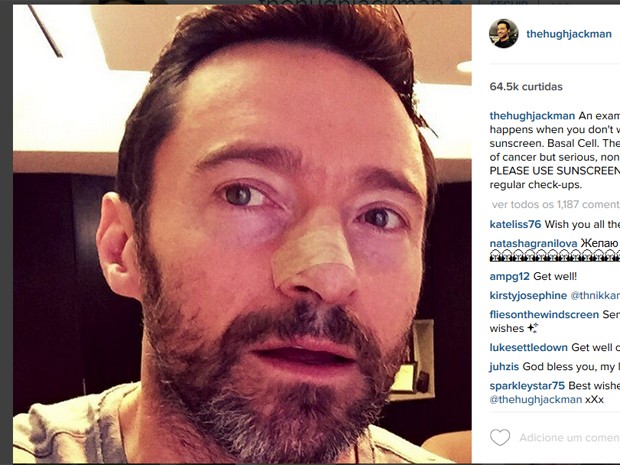 Hugh Jackman faz novo tratamento contra câncer de pele (Foto: Reprodução/Instagram)