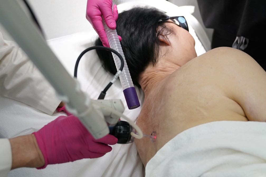 Kim Phuc recebe tratamento a laser no Miami Dermatology and Laser Institute, terça-feira, 28 de junho de 2022. Ela é tratada desde 2015 pro bono no instituto para cicatrizes sofridas no dia 8 de junho de 1972, no bombardeio de sua aldeia durante a Guerra do Vietnã. — Foto: Lynne Sladky/AP