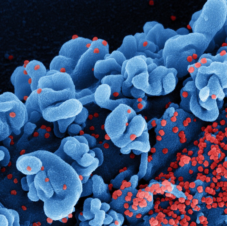 Micrografia eletrônica de varredura colorida de uma célula infectada com a cepa Ômicron de partículas do vírus Sars-CoV-2 (vermelho), isolada de uma amostra de paciente.