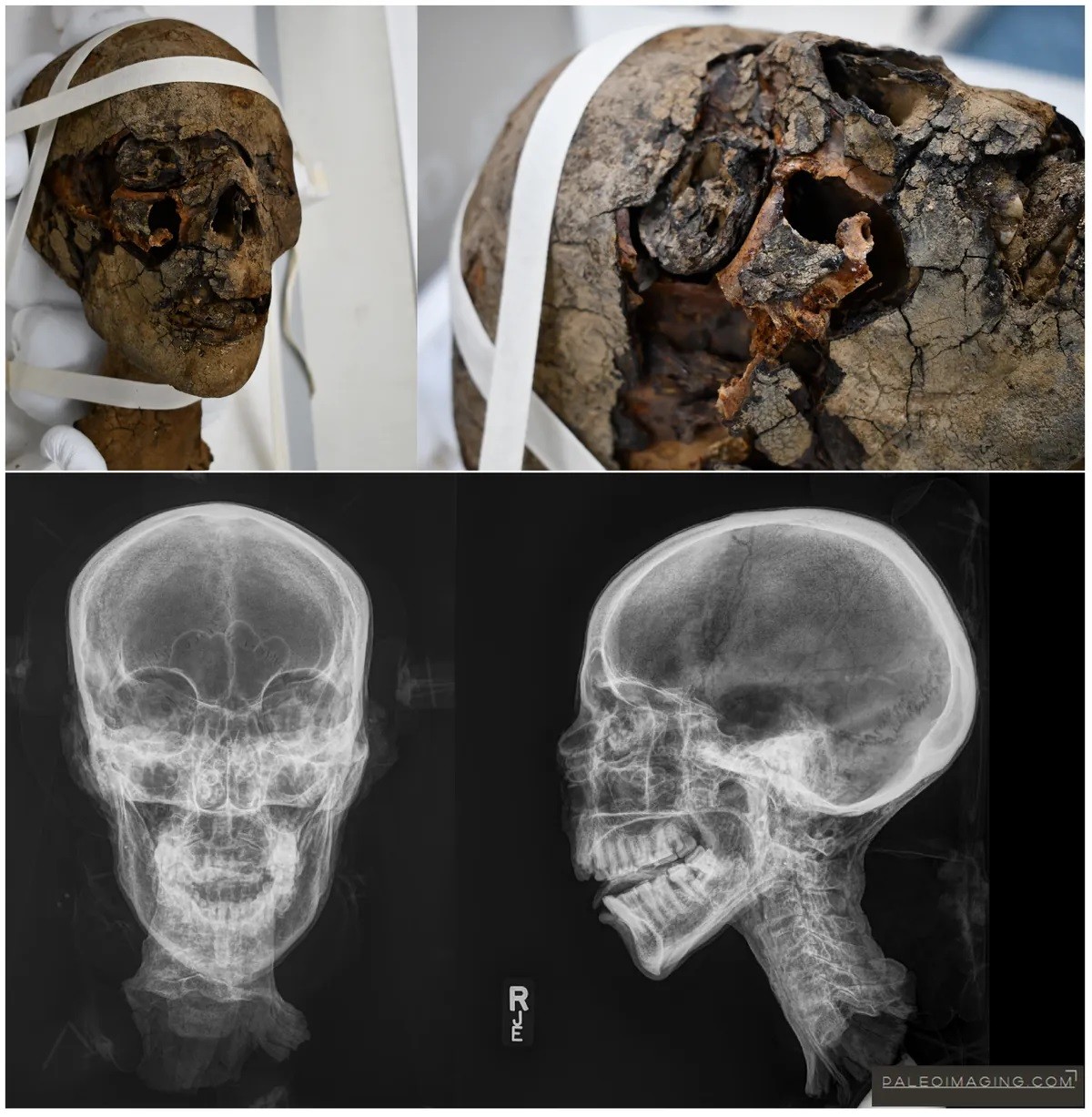 Cabeça e raio X da múmia egípcia antiga estudadas por cientistas na Inglaterra (Foto:  Maidstone e Tunbridge Wells NHS Trust)