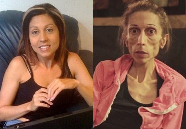 Rachael Farrokh antes e depois (Foto: Reprodução)