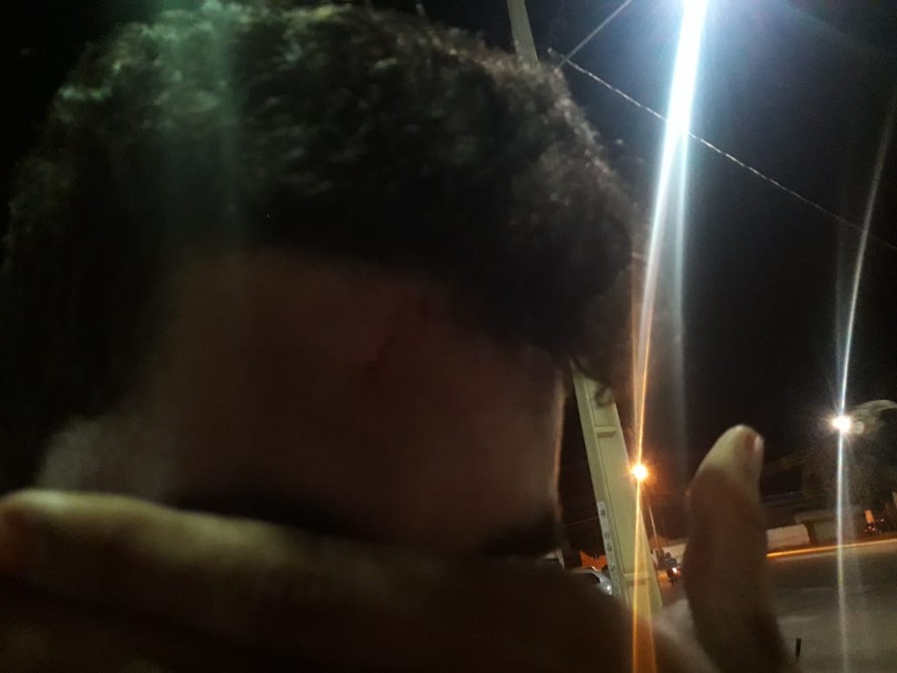 Jovem mostra marcas de agressão na testa (Foto: Divulgação)