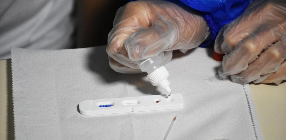 Prefeitura de Alexandria adquiriu 12 mil testes de coronavírus — Foto: Cedida