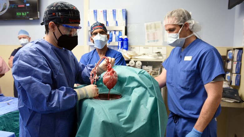 Cirurgiões realizam transplante cardíaco em Baltimore, nos Estados Unidos 07/01/2022 Escola de Medicina da Universidade de Maryland (Foto: UMSOM/Divulgação via Reuters)