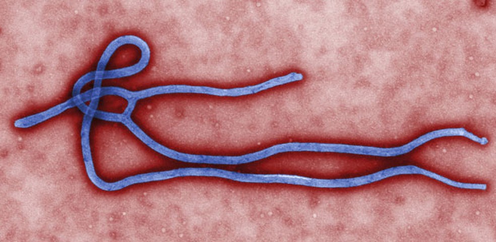 O ebola já foi detectado nos olhos e nos testículos de pacientes — Foto: Reuters