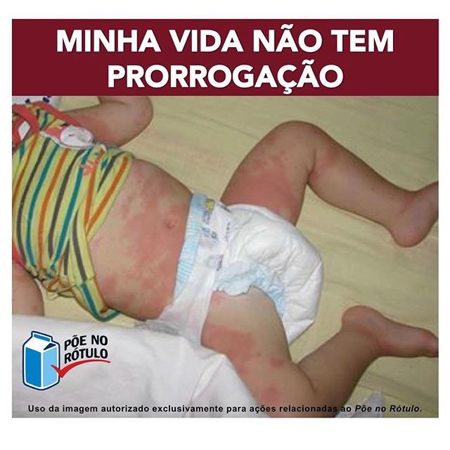 A foto da campanha traz um bebê com manchas pelo corpo, causadas por alergia alimentar (Foto: Reprodução/ Instagram)