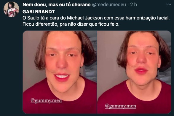Internautas apontam harmonização facial e Saulo vira meme na web (Foto: Reprodução/Twitter)