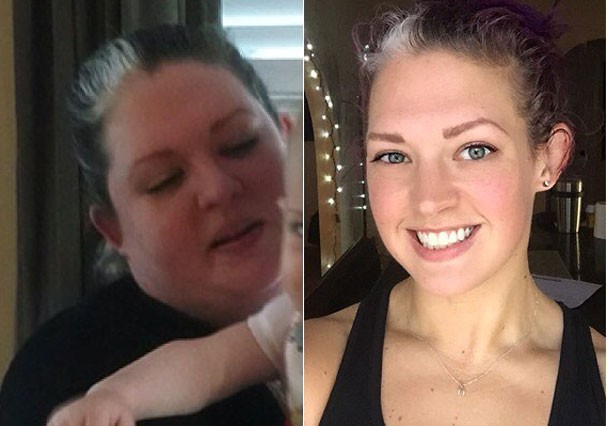 Antes e depois de Misty Mitchell (Foto: Reprodução/Instagram) Antes e depois de Misty Mitchell (Foto: Reprodução/Instagram)