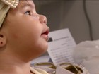 Primeira geração de crianças com microcefalia completa 1 ano 