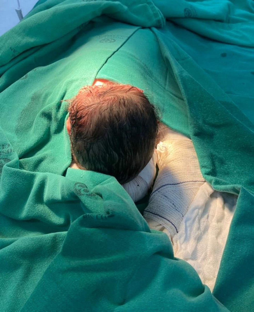 Cirurgia foi realizada com sucesso, mas bebê segue internado no Hospital da Criança tratando uma pneumonia — Foto: Arquivo pessoal 