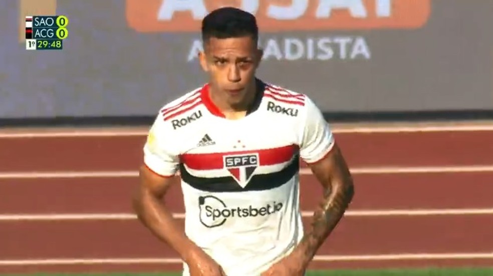 Igor Vinicius ficou com olho roxo após pancada — Foto: Reprodução