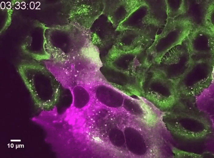 Muitas células podem se fundir, produzindo megacélulas (verdes) semelhantes às encontradas nos pulmões de pacientes com Covid-19 (Foto: D. Sanders et al./bioRxiv.org)