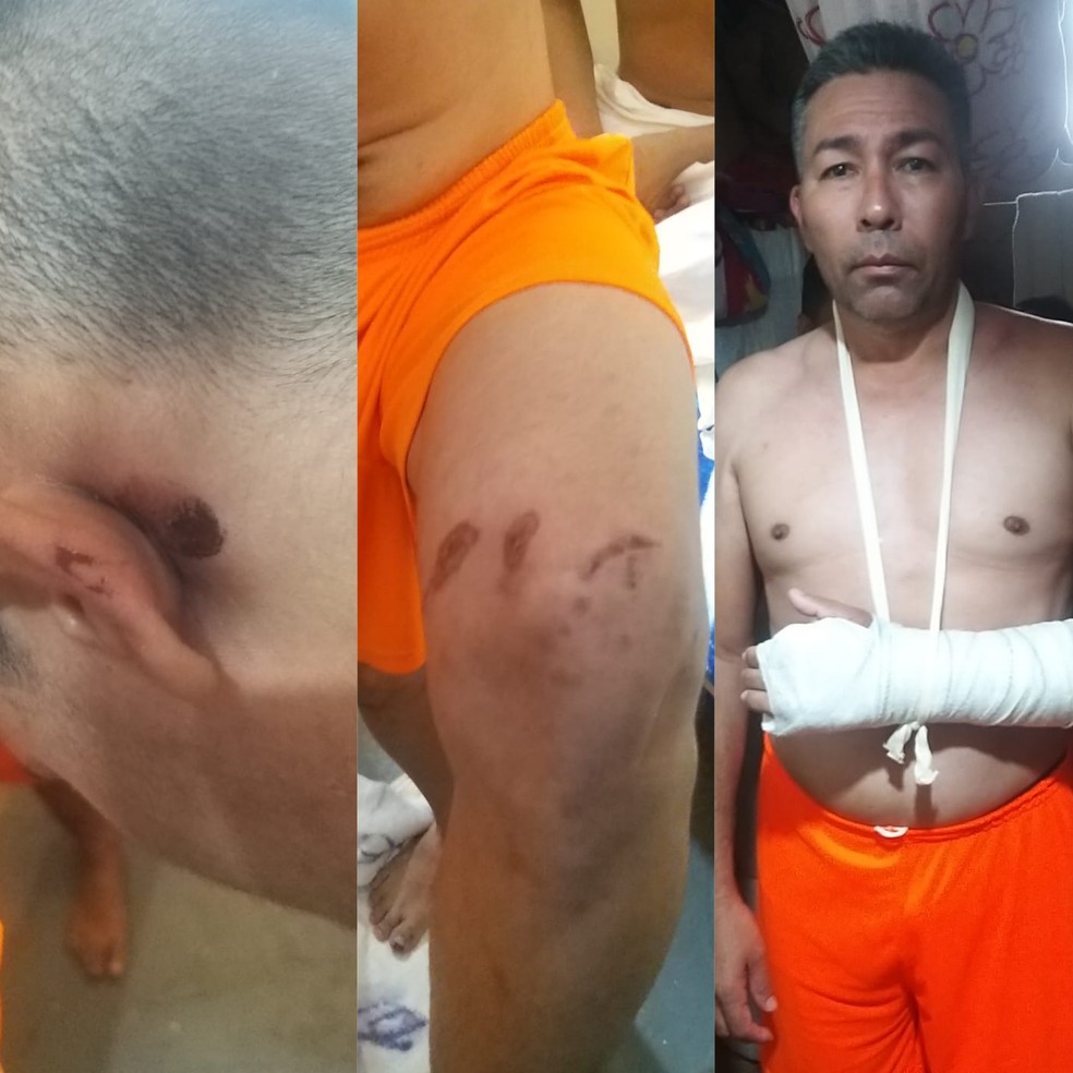 Um dos presos quebrou o braço durante a correria no pavilhão D  — Foto: Arquivo/4ª Promotoria Criminal do MP-AC