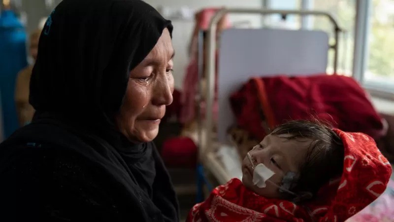 Milhões de crianças afegãs sofrem de desnutrição (Foto: Getty Images via BBC News)