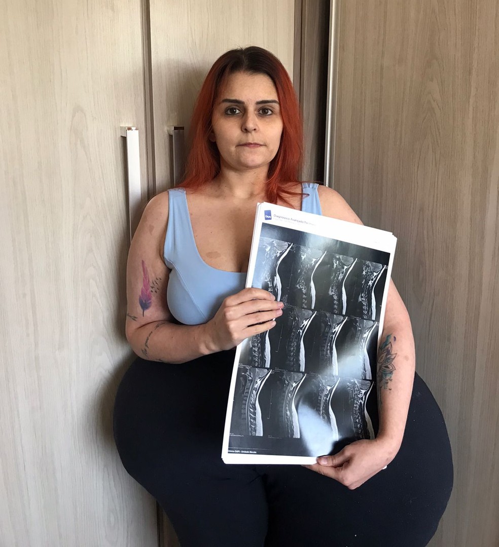 Próxima cirurgia está marcada para novembro deste ano, no Hospital Erasto Gaertner — Foto: Arquivo pessoal 