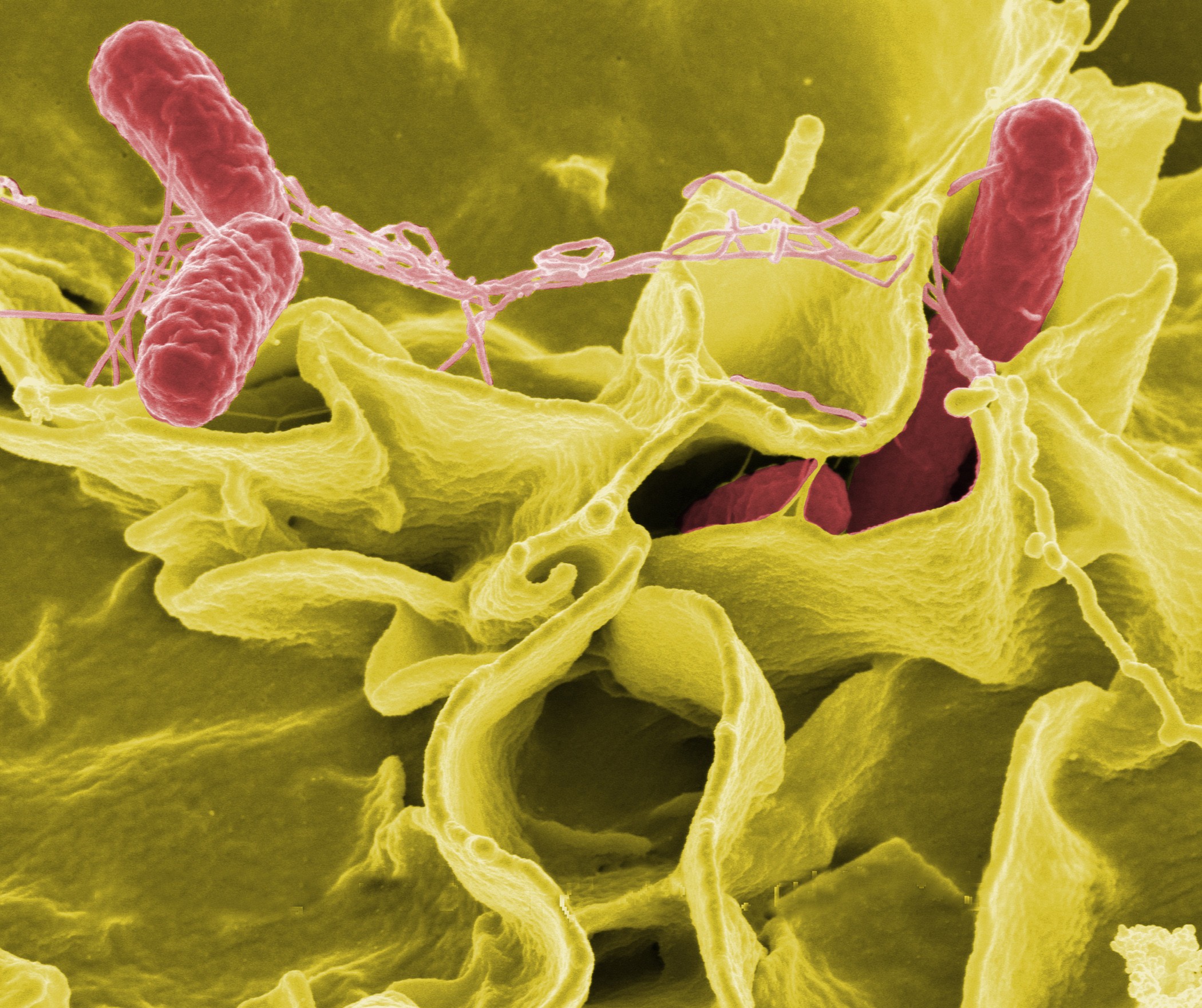 5 perguntas para entender o que é salmonella. Acima: em vermelho, Salmonella typhimurium invadindo células humanas (Foto: Wikimedia Commons)