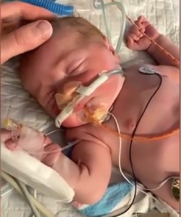O pequeno Riley, filho da cantora Meghan Trainor, logo após o parto (Foto: Reprodução Instagram)
