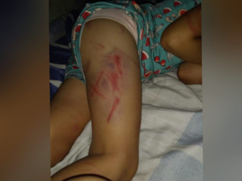 O caso de agressão foi denunciado por um vizinho que ouviu os gritos da criança e chamou a Polícia Militar. — Foto: Reprodução/TV Verdes Mares