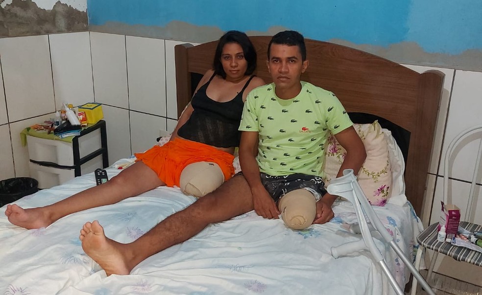 Tanto Márcio quanto Rosângela tiveram que amputar a perna esquerda após o acidente — Foto: Arquivo/ Márcio Luiz Brito 
