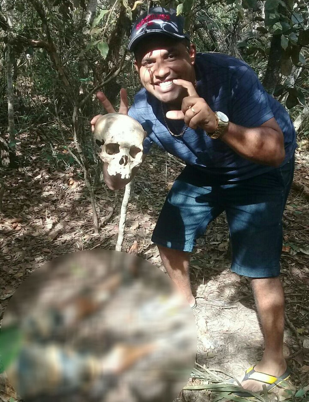 Vitima De Homem Que Postava Fotos Com Cadaveres Em Redes Sociais Levou 4 Tiros E Esta Em Recuperacao Diz Delegado Mato Grosso G1
