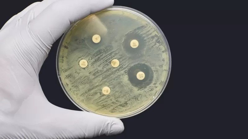 Teste laboratorial de resistência antimicrobiana (Foto: Getty Images )