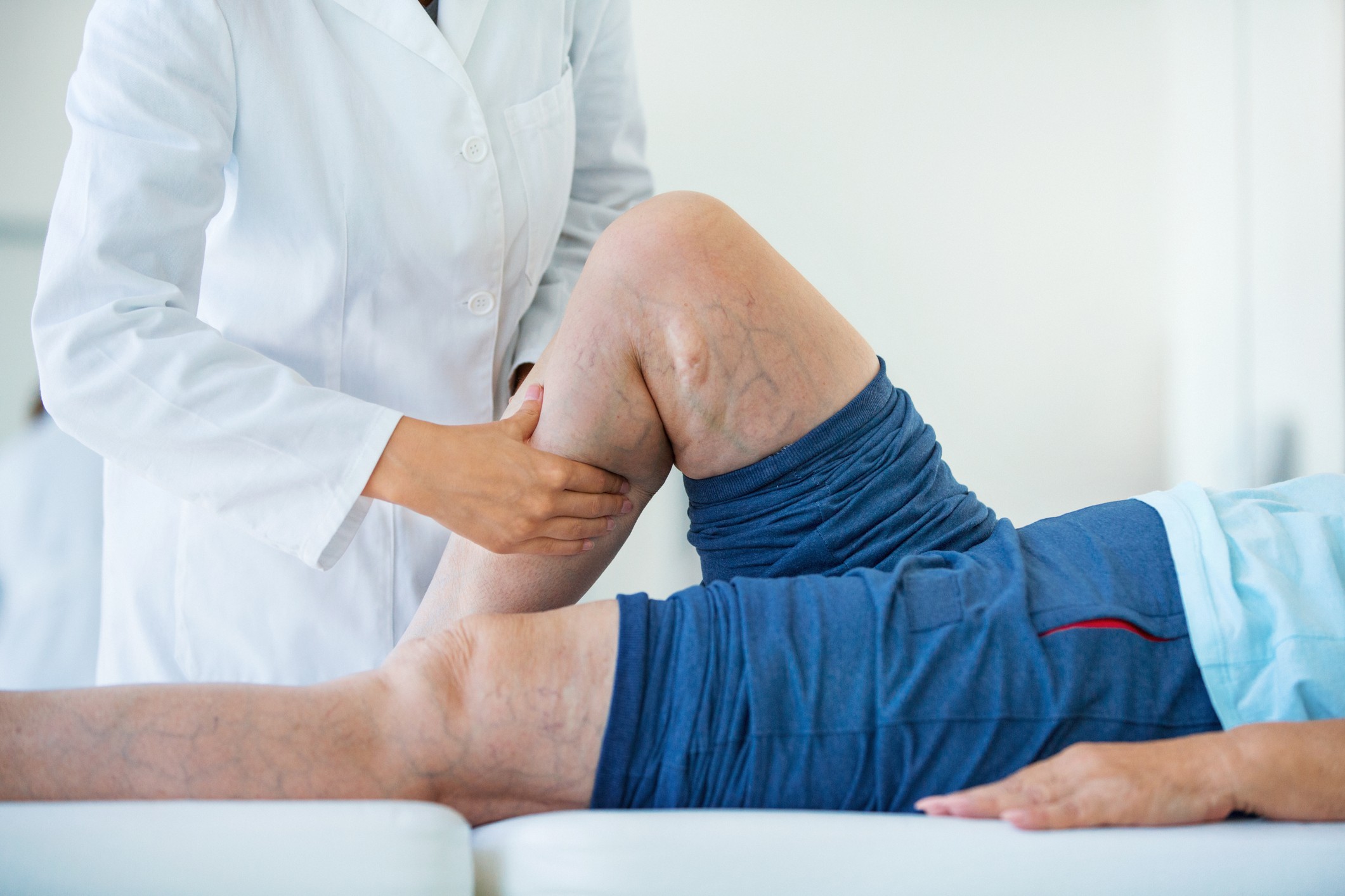 Closeup side view of unrecognizable female doctor massaging legs and calves of a senior female patient with visible varicose veins. (Foto: Getty Images/iStockphoto)