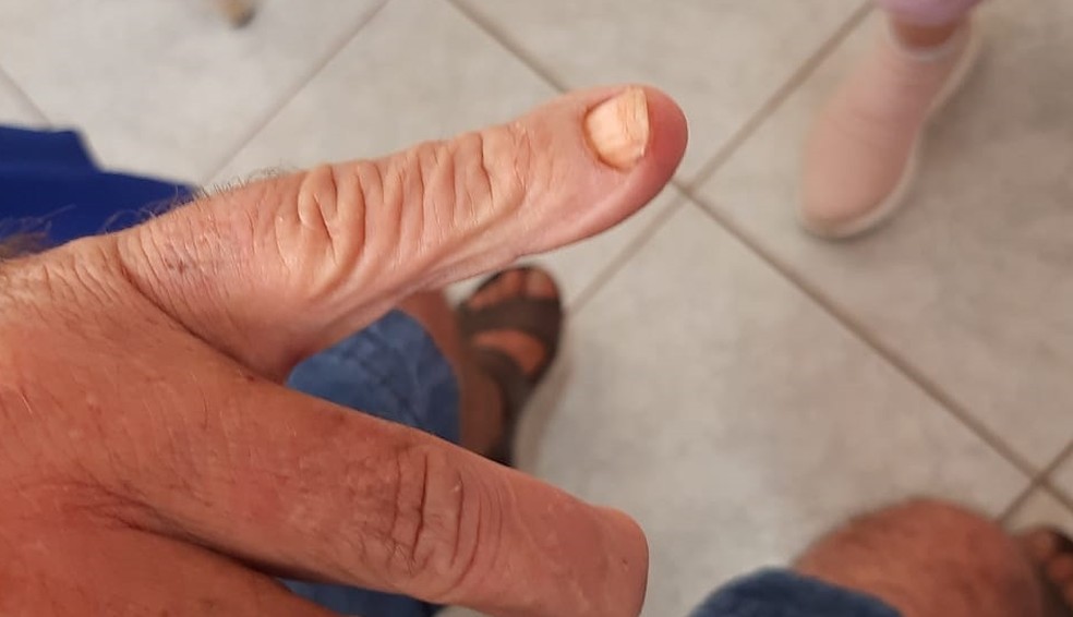 Idoso torturado em clínica de reabilitação de Sales de Oliveira (SP) teve dedos apertados com alicate — Foto: Divulgação / Polícia Civil