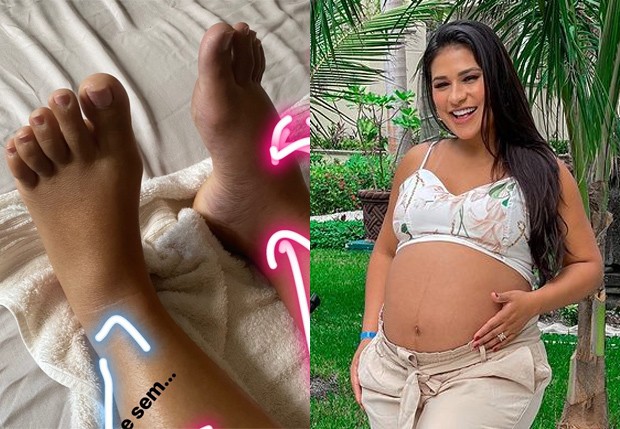 Simone mostra diferença nos pés depois (esquerdo) e antes (direito) de drenagem  (Foto: Reprodução/Instagram)