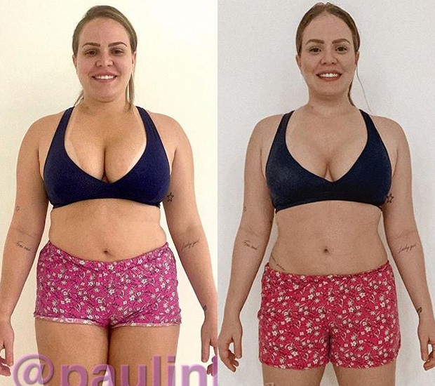 Paulinha Leite mostra antes e depois de perder 13,5 kg em 45 dias (Foto: Reprodução/Instagram)