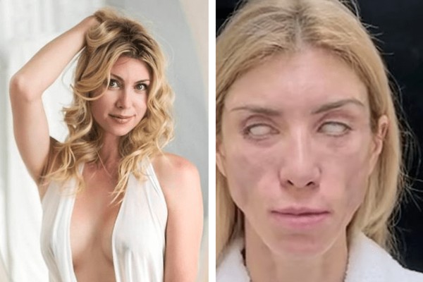 Antes e depois de Yulia Tarasevich  (Foto: Reprodução)