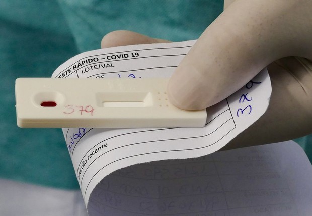 Anvisa aprova novo teste de diagnóstico para covid-19 (Foto: Leopoldo Silva/Agência Senado)
