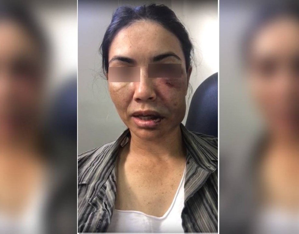 Motorista de transporte por aplicativo foi espancada por assaltantes durante uma corrida na madrugada deste sábado (24) em Tangará da Serra — Foto: Divulgação