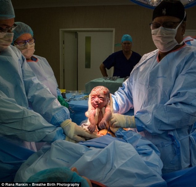 A mãe foi a primeira a puxar o bebê da barriga (Foto: Reprodução/ Daily Mail)