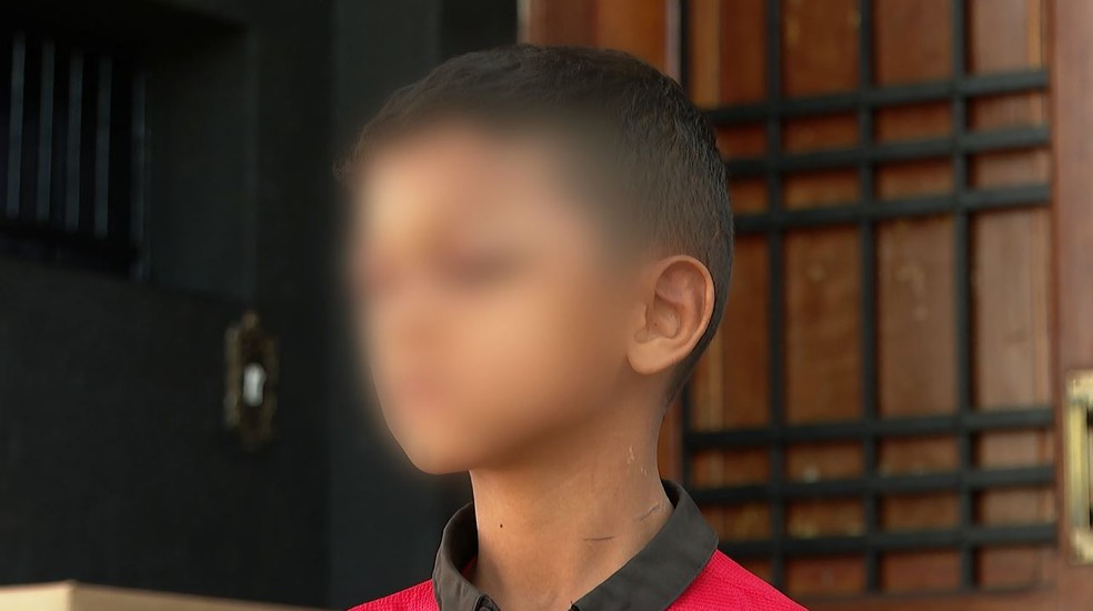 Irmão mais velho, de 7 anos, também apresenta marcas de agressão no rosto, em Jardinópolis, SP  — Foto: Reprodução/EPTV
