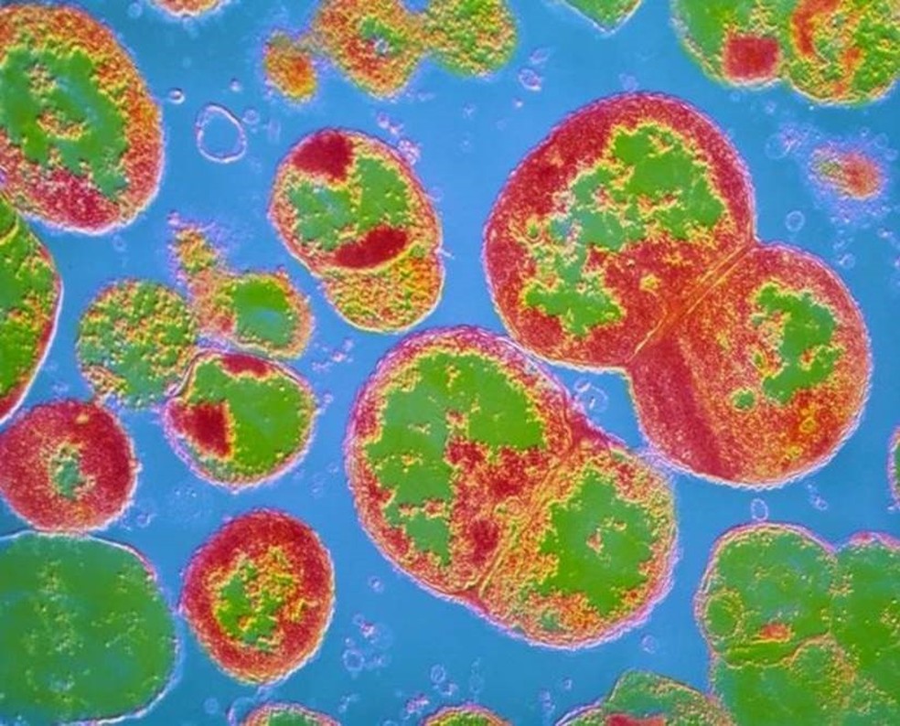 A gonorreia Ã© causada pela bacteria Neisseria (Foto: CNRI/SCIENCE PHOTO LIBRARY)