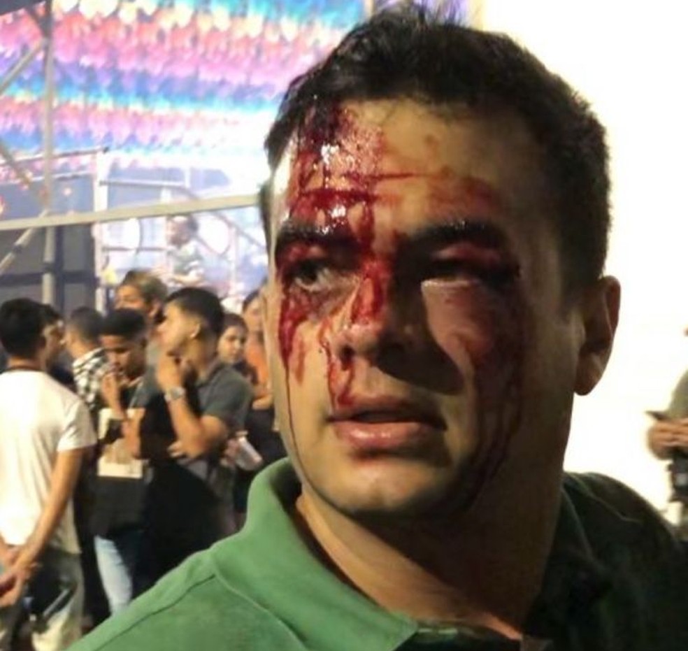 Murilo com o rosto sangrando  — Foto: Reprodução/WhatsApp