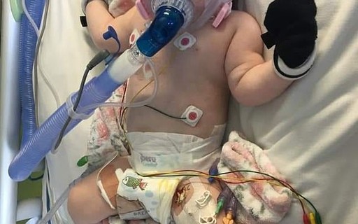 Com cardiopatia congênita grave, bebê luta para sobreviver com 