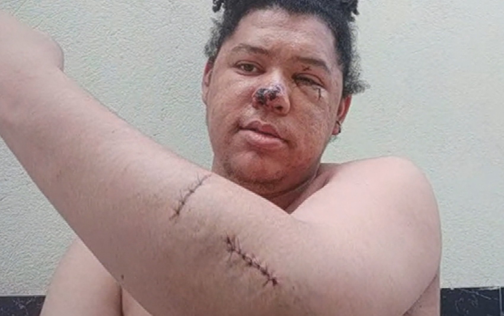 Repositor é esfaqueado dentro de supermercado e pede ajuda em áudio; ouça