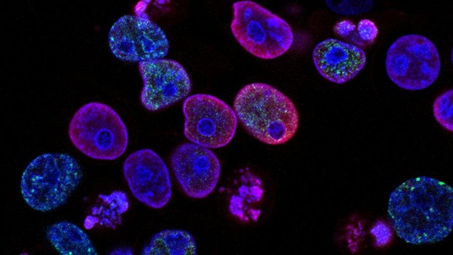 Células humanas de câncer colorretal tratadas em estudo