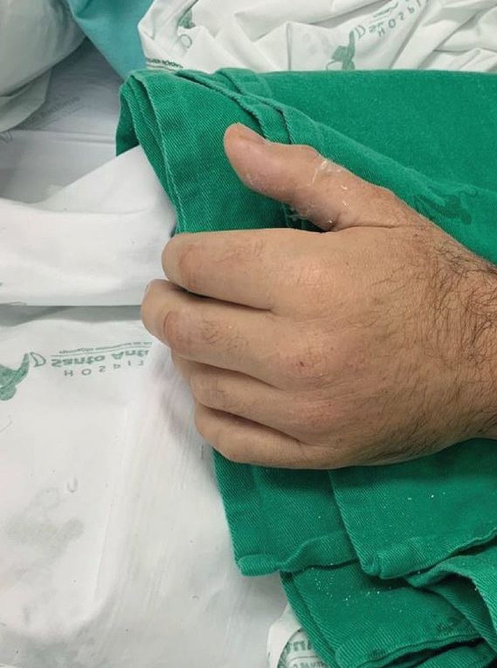 Foi a quinta vez que o hospital fez uma cirurgia como essa — Foto: Hospital Santo Antônio/Divulgação