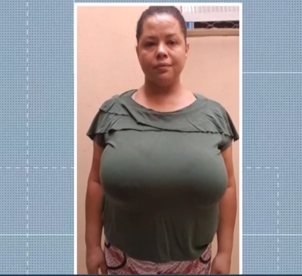 Na Espera Ha Seis Anos Por Cirurgia De Mamoplastia Mulher Pede Doacoes Para Realizar Procedimento Na Rede Particular Mato Grosso Do Sul G1