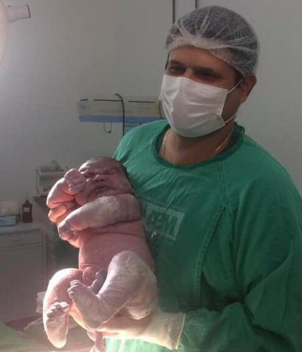 Bebe Que Nasceu Com 6 Kg E Mais De Meio Metro Recebe Alta Em Ms Levei Um Susto Quando Vi Ele Diz Mae Mato Grosso Do Sul G1