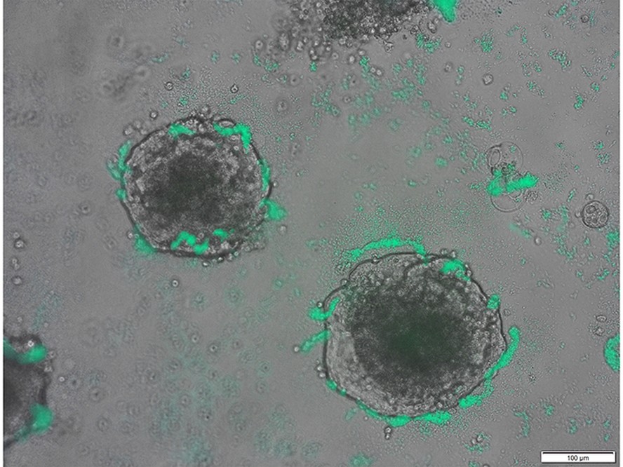 A bactéria Acinetobacter baylyi (verde) envolve aglomerados de células de câncer colorretal.'