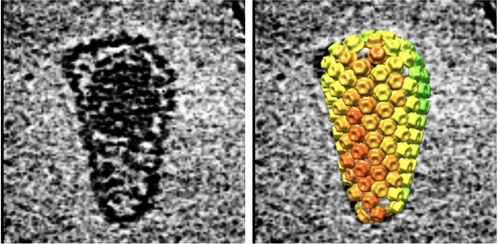 Com 130 nanômetros, o HIV é cerca de 60 vezes menor que um glóbulo vermelho. Os avanços na microscopia crioeletrônica (à esquerda) e na modelagem molecular (à direita) tornaram possível ver o vírus em detalhes sem precedentes. Usando essas técnicas, a equipe visualizou cada um dos 240 minúsculos 'blocos' de proteína que se encaixam para formar a casca externa em forma de cone. — Foto: Owen Pornillos, Barbie Ganser-Pornillos