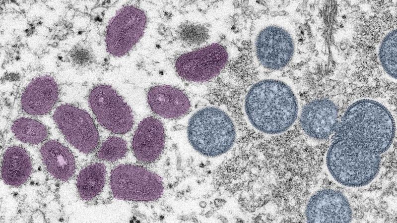 Imagem de laboratório do vírus (Foto: Getty Images via BBC News)