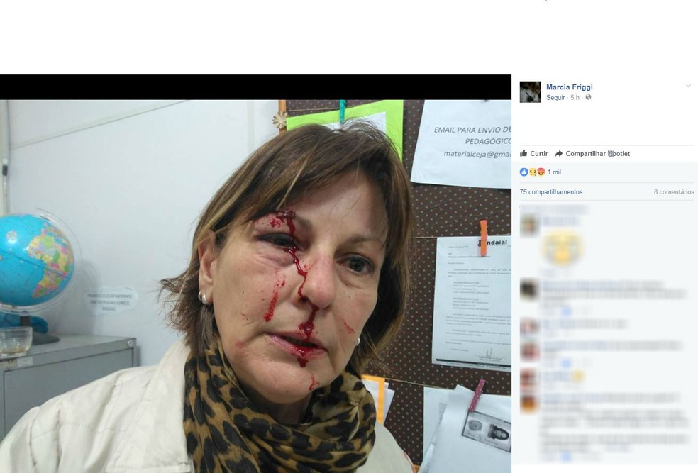 Professora postou fotos da agressão no Facebook (Foto: Reprodução/Facebook)